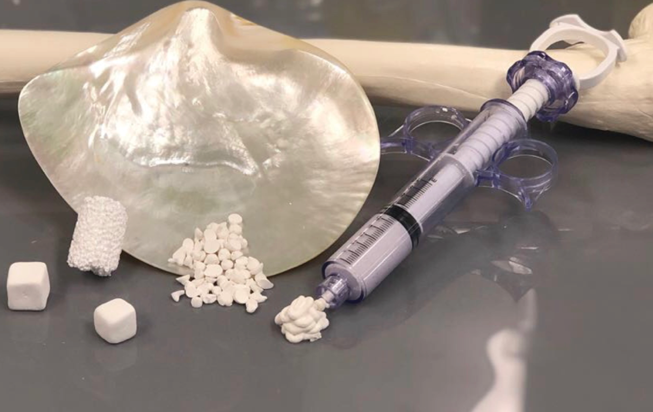 UWA has developed a patented technology for using nacre to make a substitute named PearlBone, which has been assigned to a biotech company called Marine Biomedical. | Source: Marine Biomedical